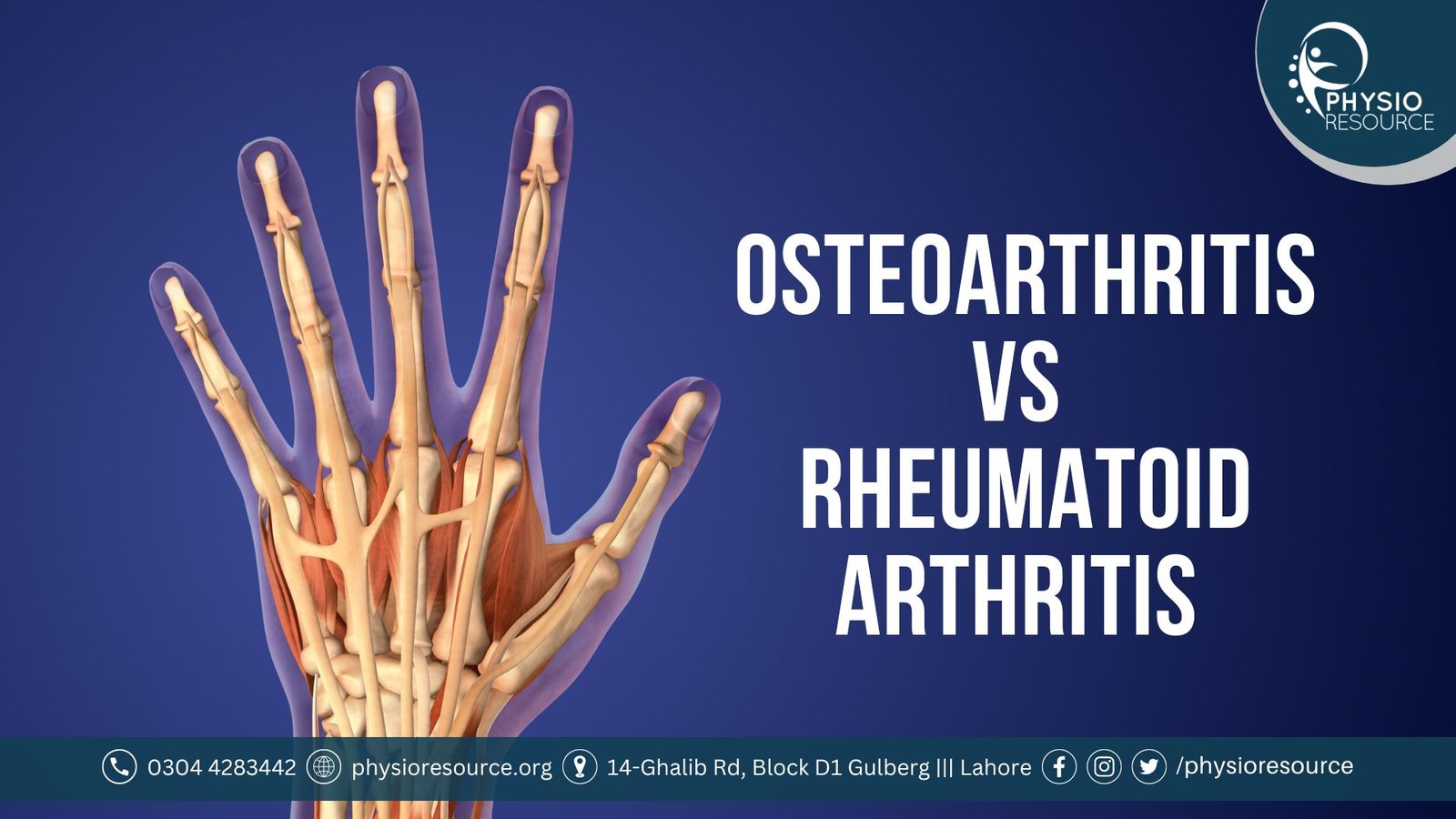 osteoarthritis vs rheumatoid arthritis