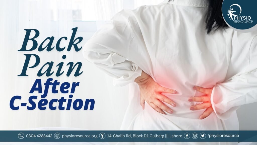 Back Pain After C-Section: Causes, Exercises and Treatment