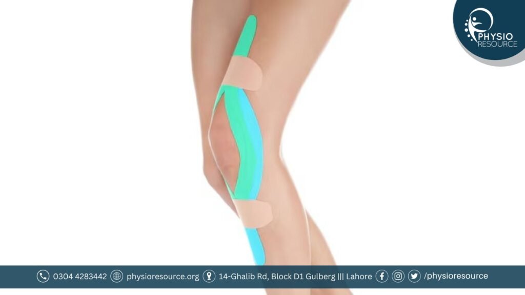 kinesiology taping techniques for different knee