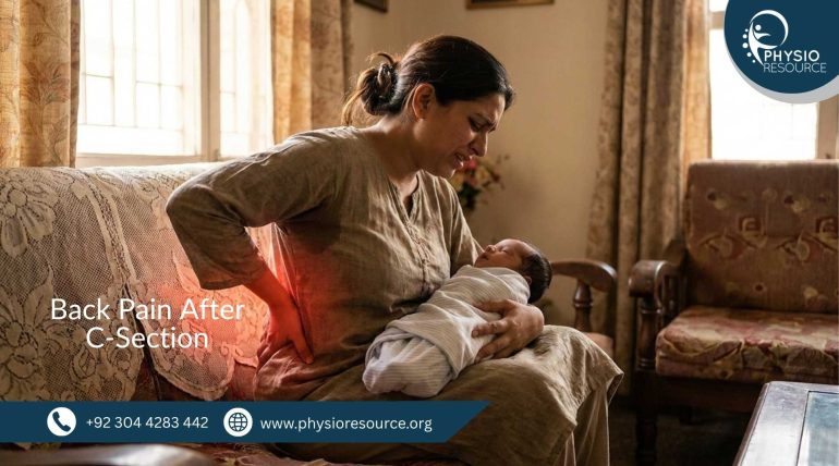 Back pain after C-section treatment at Physio Resource, Lahore