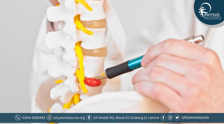 Best Slipped Disc Treatment in Lahore – advanced therapies, pain relief options, and expert physiotherapy for spine health.