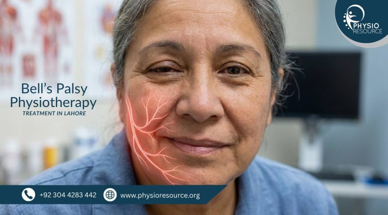 Patient performing facial physiotherapy exercises for Bell’s palsy recovery to improve muscle movement and symmetry