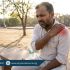 Person experiencing joint pain and fatigue due to dehydration in extreme summer heat, highlighting physiotherapy care at Physio Resource Lahore